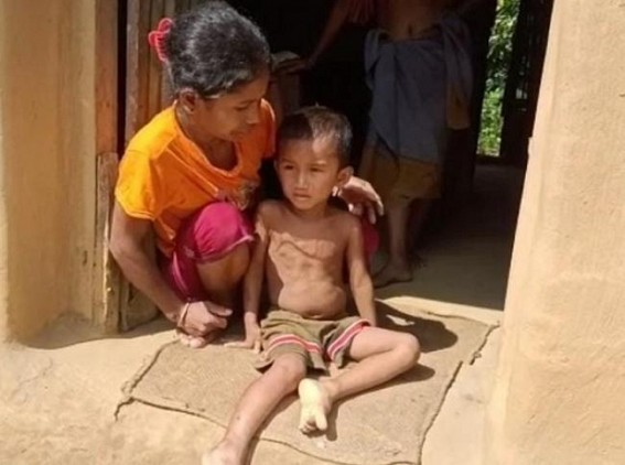 A 3.5 years old boy suffering after a snake bite in Teliamura